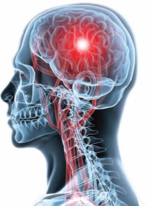 What does brain injury look like