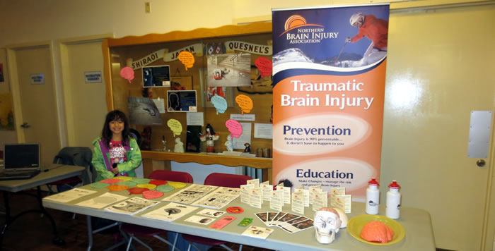 Northern Brain Association Community Development Info Booth