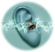 Tinnitus - Ringing in the ears